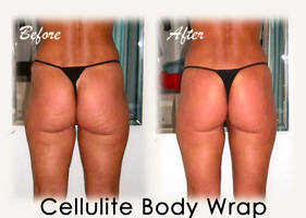 Cellulite Body Wrap